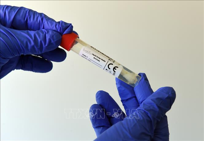 Một điểm xét nghiệm COVID-19 tại Hochfelln, Đức, ngày 30/7/2020. Ảnh: AFP/TTXVN