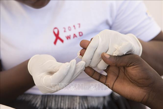 Bước đột phá tiềm năng trong điều trị HIV/AIDS