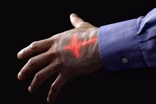 Phát triển da điện tử thông minh giúp phát hiện sớm một số bệnh