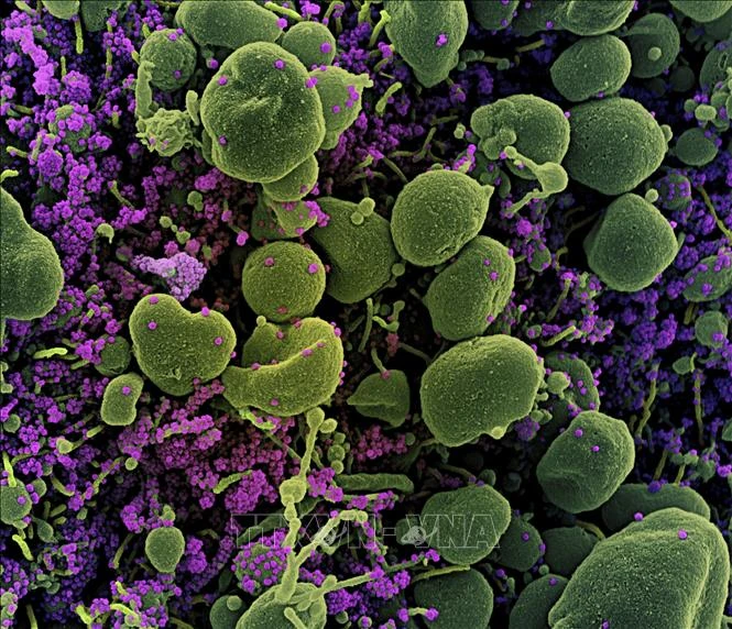 Sóng siêu âm có thể tiêu diệt virus SARS-CoV-2