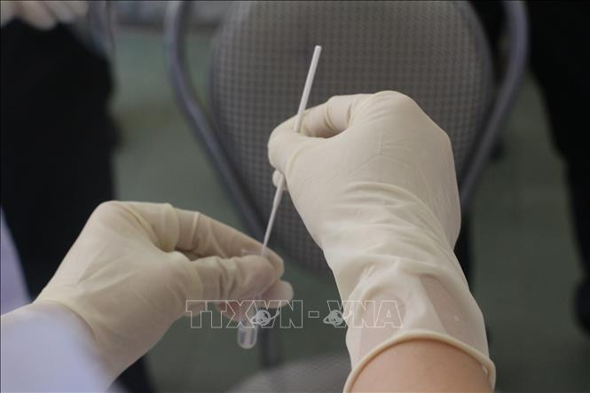 Thông tin về 2 ca tử vong do COVID-19 ở bệnh nhân có bệnh lý nền nặng