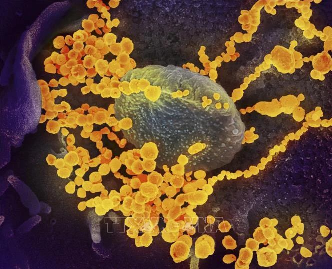 Giới khoa học Mỹ xác định gene quan trọng trong kháng thể virus SARS-CoV-2