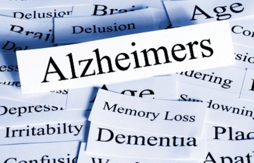 Thuốc điều trị bệnh Alzheimer của Cuba cho kết quả thử nghiệm khả quan