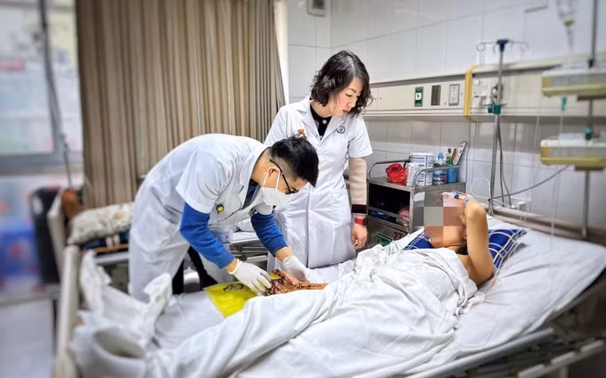 Thêm một trường hợp dập nát bàn tay do pháo tự chế phát nổ ảnh 1