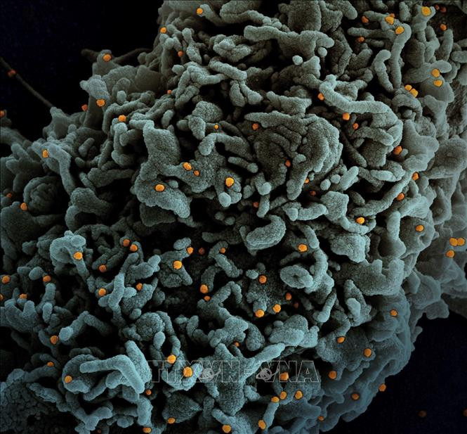 Hình ảnh quét qua kính hiển vi điện tử cho thấy tế bào (màu xanh) bị virus SARS-COV-2 (màu vàng) xâm nhập trong mẫu bệnh phẩm của bệnh nhân COVID-19 tại Viện Nghiên cứu Dị ứng và Bệnh Truyền nhiễm Quốc gia Mỹ ngày 31/3/2021. Ảnh: AFP/TTXVN Phát hiện kháng thể mới có tiềm năng trở thành liệu pháp điều trị COVID-19 ảnh 1