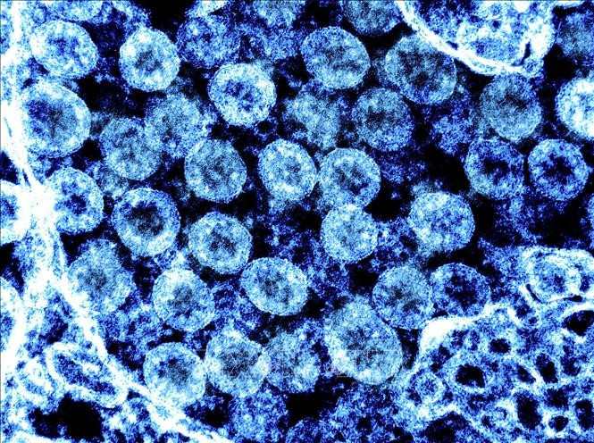 (Hình ảnh do Viện Y tế Quốc gia Mỹ (NIH) cung cấp) Virus SARS-CoV-2 chụp qua kính hiển vi điện tử trên mẫu bệnh phẩm tại phòng thí nghiệm ngày 1/8/2021. Ảnh: AFP/TTXVN Phát hiện đột phá của giới khoa học Anh về hướng điều trị hiệu quả COVID-19 ảnh 1