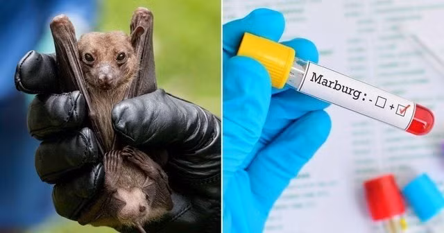 Phòng, chống dịch bệnh marburg: Bình Phước kiểm soát chặt người nhập cảnh