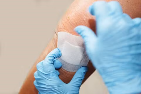 Miếng dán đặc biệt giúp vết thương mau lành