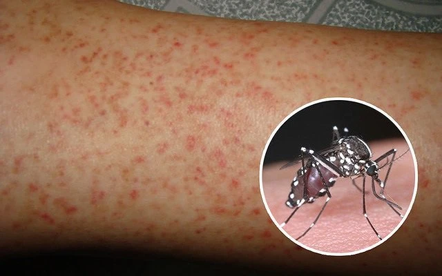 Đắk Nông triển khai chiến dịch diệt lăng quăng, phòng sốt xuất huyết