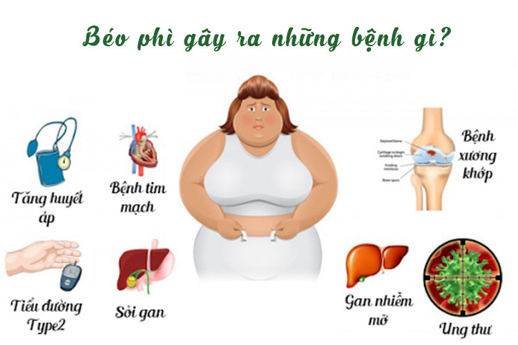 Triển vọng trong việc phát triển thuốc chống béo phì