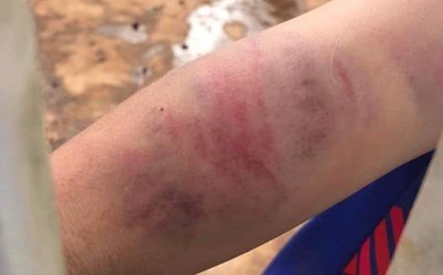 Vụ việc cháu bé 9 tuổi bị đánh đập ở Đắk Lắk: Khởi tố bà nội và cha ruột cháu bé