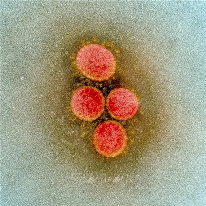 Hình ảnh từ kính hiển vi do Viện Y tế quốc gia Mỹ cung cấp cho thấy virus SARS-CoV-2 trong mẫu bệnh phẩm của bệnh nhân mắc COVID-19 ở Mỹ. Ảnh: AFP/TTXVN