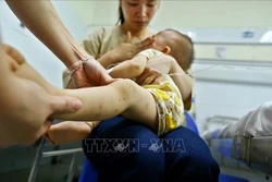 Lâm Đồng khuyến cáo người dân chủ động phòng bệnh tay chân miệng cho trẻ