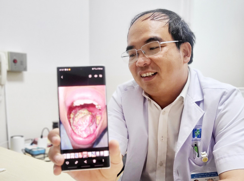 Tái tạo lưỡi cho nhiều bệnh nhân ung thư
