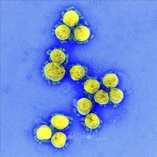 Hình ảnh từ kính hiển vi do Viện Y tế quốc gia Mỹ cung cấp cho thấy virus SARS-CoV-2 trong mẫu bệnh phẩm của bệnh nhân mắc COVID-19 ở Mỹ. Ảnh: AFP/TTXVN Phát hiện biến thể mới của virus SARS-CoV-2 chứa đột biến lạ ảnh 1