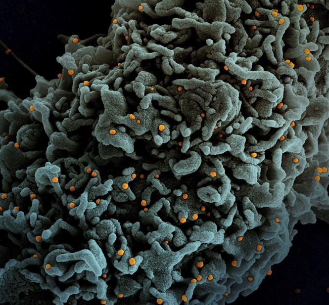 Hình ảnh quét qua kính hiển vi điện tử cho thấy tế bào (màu xanh) bị virus SARS-COV-2 (màu cam) xâm nhập, lấy từ mẫu bệnh phẩm của bệnh nhân COVID-19 tại Viện Nghiên cứu Dị ứng và Bệnh Truyền nhiễm Quốc gia, Mỹ ngày 31/3/2021. Ảnh: AFP/TTXVN Cơ thể không sản sinh kháng thể chống SARS-CoV-2 sau khi nhiễm các chủng virus corona thông thường ảnh 1