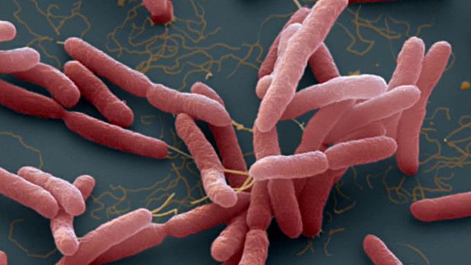 Vi khuẩn Burkholderia pseudomallei gây bệnh Whitmore. Nguồn: benhvien108.vn Đắk Lắk: Ghi nhận một trường hợp mắc bệnh Whitmore ảnh 2