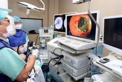 Lần đầu thực hiện kỹ thuật tán sỏi đường mật trong gan bằng laser tại miền Trung- Tây Nguyên