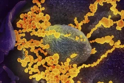 Giới khoa học Mỹ xác định gene quan trọng trong kháng thể virus SARS-CoV-2