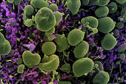 Phát hiện khí ozone có thể khử khuẩn bề mặt có virus SARS-CoV-2