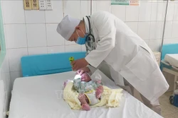 Bệnh nhi S.H. tỉnh táo, sức khỏe bình phục tốt sau khi được phẫu thuật cắt bỏ khối thoát vị não vùng chẩm. Ảnh: Lê Xuân-TTXVN