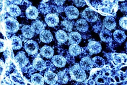 Virus SARS-CoV-2 và những điều cần biết về vaccine, sự suy giảm kháng thể và bộ nhớ hệ miễn dịch