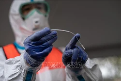 Nhật Bản cho phép xét nghiệm virus SARS-CoV-2 qua nước bọt