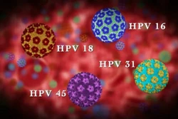 Tìm ra phương pháp điều trị tiềm năng cho các bệnh nhân nhiễm HPV
