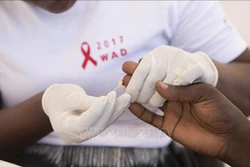 Bước đột phá tiềm năng trong điều trị HIV/AIDS