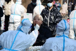 Xét nghiệm nước bọt phát hiện virus SARS-CoV-2 nhanh hơn xét nghiệm dịch mũi họng