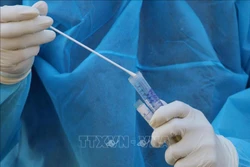 Dịch COVID-19: Tăng năng lực xét nghiệm SARS-CoV-2 thông qua phương pháp gộp mẫu
