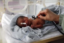 Suy dinh dưỡng gây thiệt hại lên tới 850 tỷ USD cho giới doanh nghiệp tại các nước đang phát triển