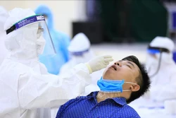 Dịch COVID-19: Tăng năng lực xét nghiệm cho toàn ngành Y tế