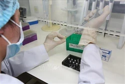 Dịch COVID-19: Tập trung nguồn lực chủ động sản xuất bộ xét nghiệm virus SARS-CoV-2