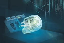 Ảnh minh họa.(Nguồn: Siemens)