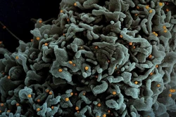 Hình ảnh quét qua kính hiển vi điện tử cho thấy tế bào (màu xanh) bị virus SARS-COV-2 (màu cam) xâm nhập, lấy từ mẫu bệnh phẩm của bệnh nhân COVID-19 tại Viện Nghiên cứu Dị ứng và Bệnh Truyền nhiễm Quốc gia, Mỹ ngày 31/3/2021. Ảnh: AFP/TTXVN 
