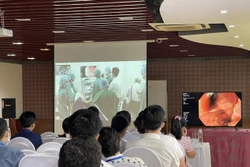 Tầm soát sớm – Chìa khóa vàng phòng ngừa ung thư tiêu hóa