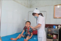 Tuyên Quang: Bốn trẻ nhỏ ngộ độc do ăn thịt cóc
