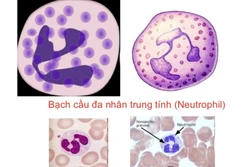 Phát hiện tế bào miễn dịch tiềm năng điều trị ung thư