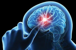 Thời tiết lạnh đột ngột, người bệnh tim mạch dễ đột quỵ bất cứ lúc nào
