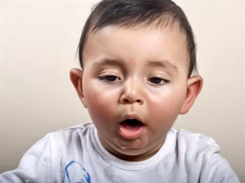 Xử trí tại chỗ dị vật đường thở cho trẻ ảnh 1 Xử trí tại chỗ dị vật đường thở cho trẻ ảnh 1