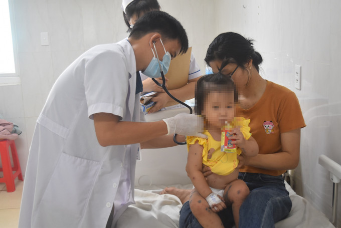 Bác sĩ tại Khoa Nhi Tổng hợp, Bệnh viện Đa khoa vùng Tây Nguyên, khám cho bệnh nhi bị tay chân miệng. Bác sĩ tại Khoa Nhi Tổng hợp, Bệnh viện Đa khoa vùng Tây Nguyên, khám cho bệnh nhi bị tay chân miệng.