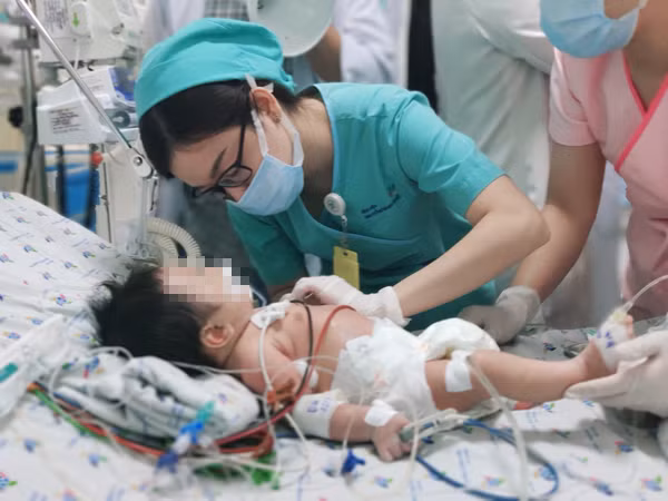 Sặc hạt điều, bé trai hai tuổi suy hô hấp phải thở máy